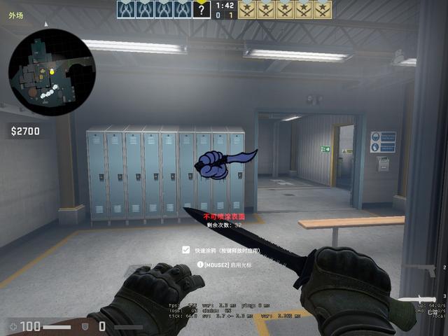 球突分导致 球突分导致